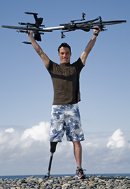 prosthetic fit prosthetists and physicians prosthetics education Physical Therapist Bolingbrook Illinois